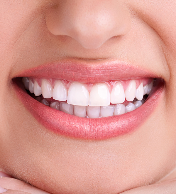 Ästhetische Zahnheilkunde